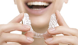 Occlusal Guard | Superior Family Dentistry Occlusal Guard | Superior Family Dentistry